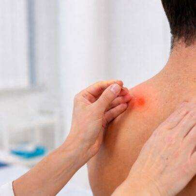 Trigger point